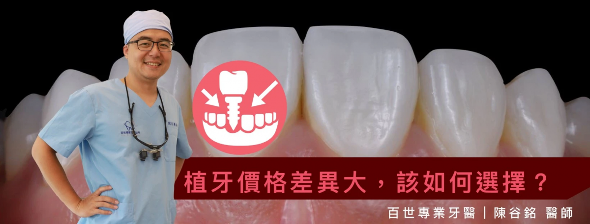 植牙價格有高有低，到底該如何做出適合自己的選擇？百世專業牙醫診所陳谷銘院長告訴您。