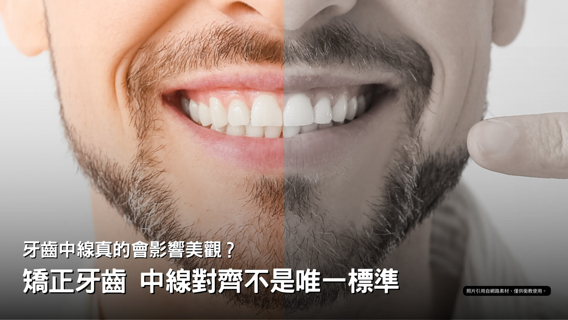 牙齒中線對齊影響牙齒矯正嗎？