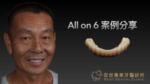 百世專業牙醫案例