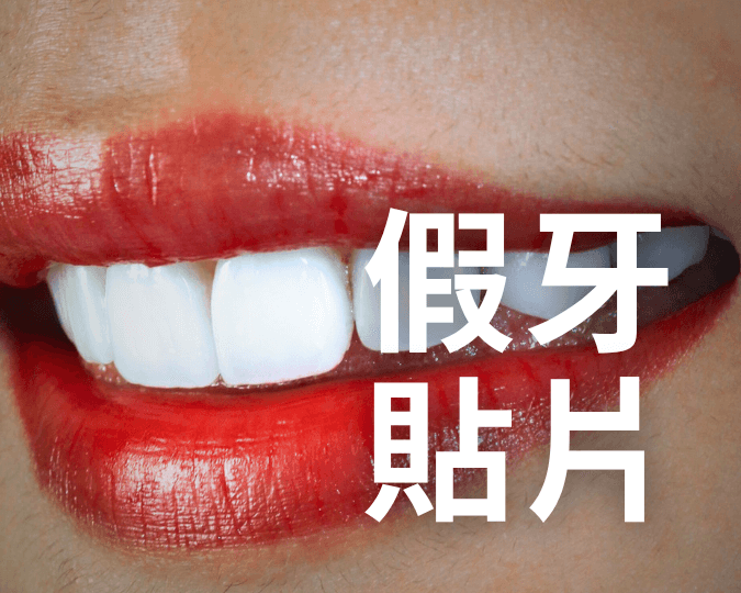 假牙貼片20250605
