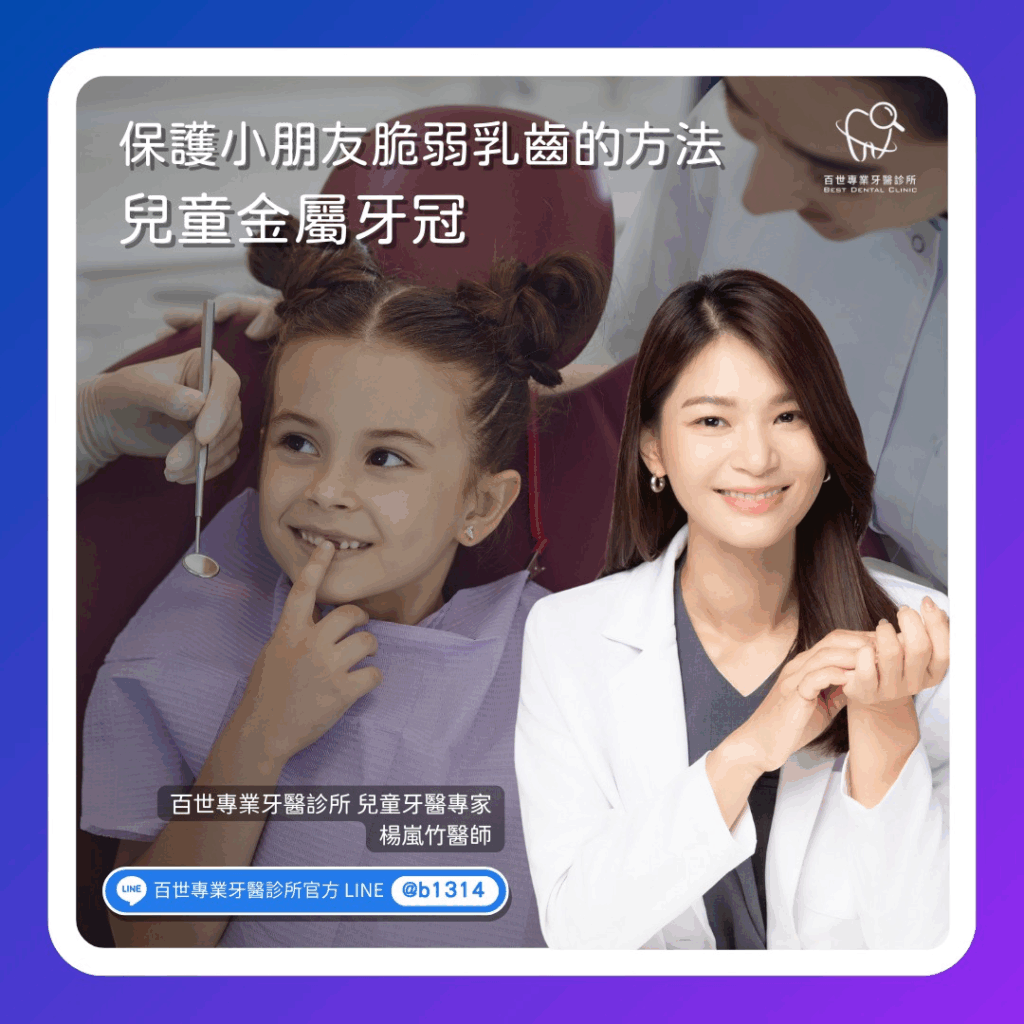乳牙反正要換,還該裝牙冠嗎?兒童金屬牙冠